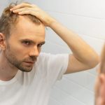 Balding-man-thinking-he-may-need-hair-implants