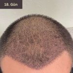 xr:d:DAFg_16xnFU:28,j:45838701000,t:23042507